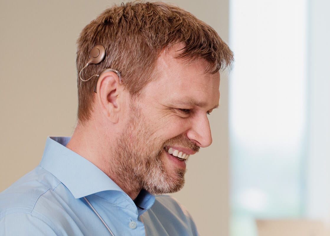 Implant cochléaire invisible entendre par stimulation électrique